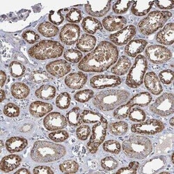 MAGOH Antibody, Novus Biologicals:Antibodies:Primary Antibodies