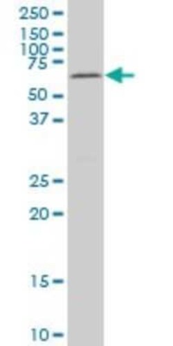 MAK Antibody (3E5), Novus Biologicals 0.1 mg; Unconjugated:Antibodies,