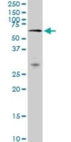MAK Antibody (3E5), Novus Biologicals 0.1 mg; Unconjugated:Antibodies,