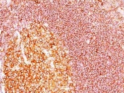 MALT1 Antibody (SPM578) - Azide and BSA Free, Novus Biologicals 0.1 mg;