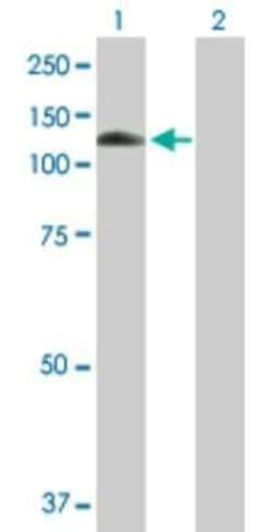 MANBA Antibody, Novus Biologicals 0.05 mg | Buy Online | Novus Biologicals | Fisher Scientific