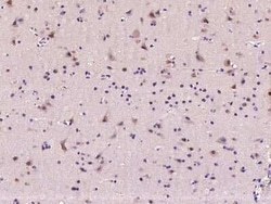MAP1 Antibody, Novus Biologicals:Antibodies:Primary Antibodies