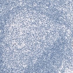 MAP2 Antibody (CL5420), Novus Biologicals 100 &mu;L | Buy Online | Novus Biologicals | Fisher Scientific