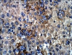 MAP3K8/Tpl2/COT Antibody, Novus Biologicals MAP3K8/Tpl2/COT Antibody; Unconjugated;