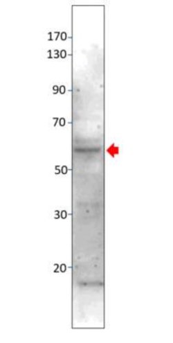 MAP3K8/Tpl2/COT Antibody, Novus Biologicals MAP3K8/Tpl2/COT Antibody; Unconjugated;