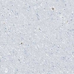 MAP4K1 Antibody, Novus Biologicals 25 &mu;L | Buy Online | Novus Biologicals | Fisher Scientific