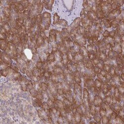 MAP4K6 Antibody, Novus Biologicals:Antibodies:Primary Antibodies