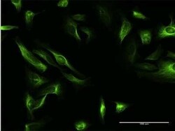 MAP7 Antibody, Novus Biologicals 0.05 mg | Buy Online | Novus Biologicals | Fisher Scientific