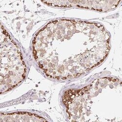 MAP7D2 Antibody, Novus Biologicals:Antibodies:Primary Antibodies