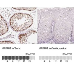 MAP7D2 Antibody, Novus Biologicals:Antibodies:Primary Antibodies