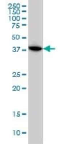 MAPKAP Kinase 3 Antibody (2B5), Novus Biologicals 0.1 mg | Buy Online | Novus Biologicals | Fisher Scientific