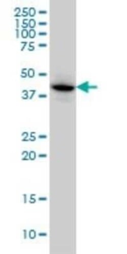 MAPKAP Kinase 3 Antibody (3F4), Novus Biologicals 0.1 mg | Buy Online | Novus Biologicals | Fisher Scientific