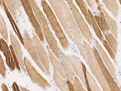 MAPKAP Kinase 3 Antibody, Novus Biologicals™