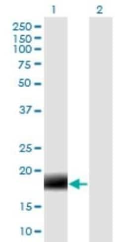 MARCH2 Antibody (7F3), Novus Biologicals 0.1 mg | Buy Online | Novus Biologicals | Fisher Scientific