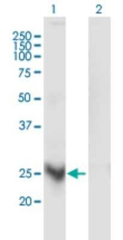 MARCH3 Antibody (1F6), Novus Biologicals 0.1 mg | Buy Online | Novus Biologicals | Fisher Scientific