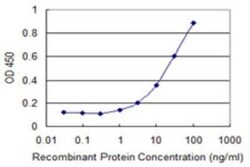 MARCH5 Antibody (3C3), Novus Biologicals 0.1 mg | Buy Online | Novus Biologicals | Fisher Scientific