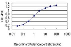 MARCKS Antibody (2C2), Novus Biologicals 50 &mu;g | Buy Online | Novus Biologicals | Fisher Scientific