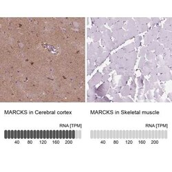 MARCKS Antibody, Novus Biologicals:Antibodies:Primary Antibodies