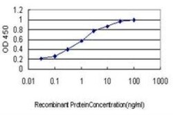 MARK2 Antibody (3B12), Novus Biologicals 0.1 mg | Buy Online | Novus Biologicals | Fisher Scientific