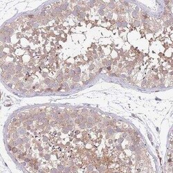 MARVELD2 Antibody, Novus Biologicals 25 &mu;L | Buy Online | Novus Biologicals | Fisher Scientific