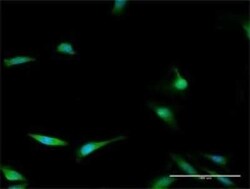 MASA Antibody, Novus Biologicals 0.1 mg | Buy Online | Novus Biologicals | Fisher Scientific