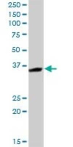 MASA Antibody, Novus Biologicals 0.1 mg | Buy Online | Novus Biologicals | Fisher Scientific