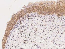 MAST4 Antibody, Novus Biologicals 100 &mu;g; Unconjugated:Antibodies, Polyclonal