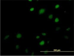 MAZ Antibody (3D2), Novus Biologicals 0.1 mg | Buy Online | Novus Biologicals | Fisher Scientific