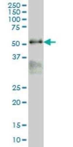 MAZ Antibody (6G2), Novus Biologicals 0.1 mg | Buy Online | Novus Biologicals | Fisher Scientific