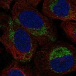 MBD3L5 Rabbit anti-Human, Polyclonal, Novus Biologicals:Antibodies:Primary