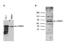 MBD4 Rabbit anti-Human, Polyclonal, Novus Biologicals 25 &mu;g | Buy Online | Novus Biologicals | Fisher Scientific