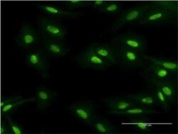 Novus Biologicals MBD5 Antibody (4A12-1B6), Novus Biologicals 0.1 mg | Buy Online | Novus Biologicals&trade; | Fisher Scientific