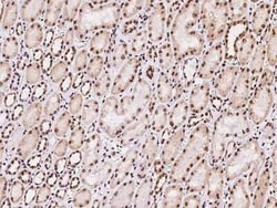 MBD5 Antibody, Novus Biologicals:Anticuerpos:Anticuerpos primarios
