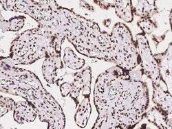 MBD5 Antibody, Novus Biologicals:Anticuerpos:Anticuerpos primarios