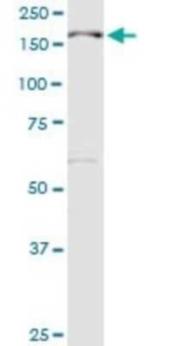MBD5 Antibody, Novus Biologicals 0.1 mg | Buy Online | Novus Biologicals | Fisher Scientific