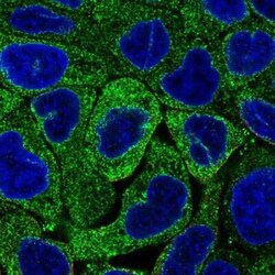 MBOAT7 Antibody, Novus Biologicals:Antibodies:Primary Antibodies