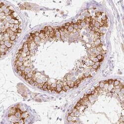 MBOAT7 Antibody, Novus Biologicals:Antibodies:Primary Antibodies