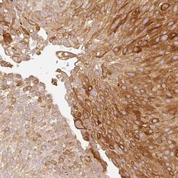 MBOAT7 Antibody, Novus Biologicals:Antibodies:Primary Antibodies