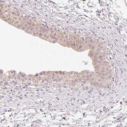 MBOAT7 Antibody, Novus Biologicals:Antibodies:Primary Antibodies