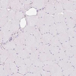 MBOAT7 Antibody, Novus Biologicals:Antibodies:Primary Antibodies