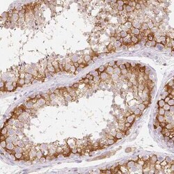 MBOAT7 Antibody, Novus Biologicals:Antibodies:Primary Antibodies