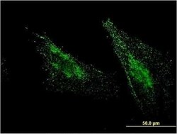 MBTPS1 Antibody (2E6), Novus Biologicals 0.1 mg | Buy Online | Novus Biologicals | Fisher Scientific