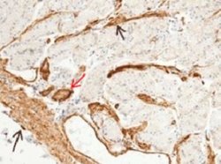 MCAM/CD146 Rabbit anti-Human, Clone: 5, Novus Biologicals 50 &mu;g; Unconjugated:Antibodies,