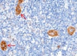 MCAM/CD146 Rabbit anti-Human, Clone: 5, Novus Biologicals 50 &mu;g; Unconjugated:Antibodies,