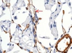 MCAM/CD146 Rabbit anti-Human, Clone: 5, Novus Biologicals 50 &mu;g; Unconjugated:Antibodies,