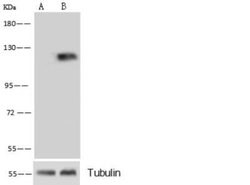 MCAM/CD146 Rabbit anti-Human, Clone: 12, Novus Biologicals 100 &mu;g; Unconjugated:Antibodies,