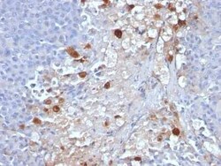 MCAM/CD146 Antibody (MCAM/1101), Novus Biologicals 0.1mg; Unlabeled:Antibodies,