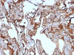 MCAM/CD146 Antibody (MUC18/1130), Novus Biologicals:Antibodies:Primary