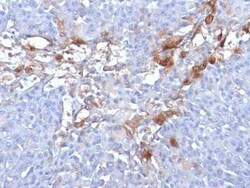 MCAM/CD146 Antibody (MUC18/1130), Novus Biologicals:Antibodies:Primary