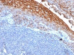 MCAM/CD146 Antibody (MUC18/1130), Novus Biologicals:Antibodies:Primary